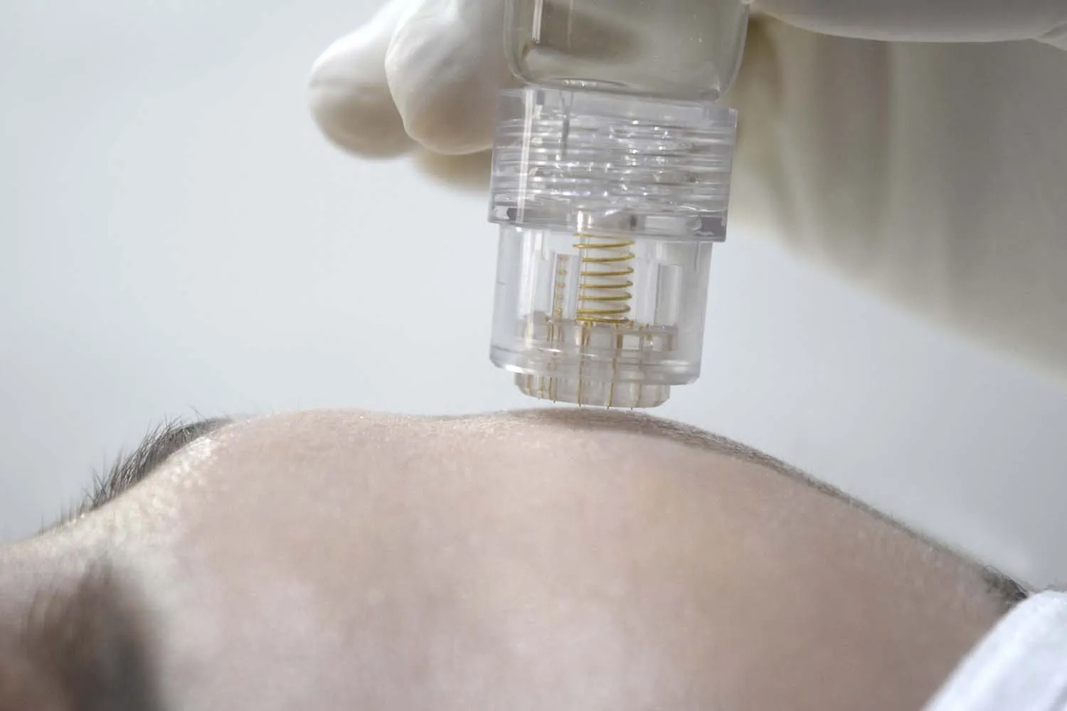 Dermastir Microneedling Stamp-on Gold 24k